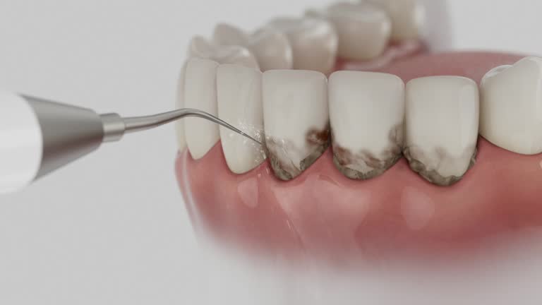 Reliable Dental Implants contractor in Wyndham, VA by Smile Center Dentistry